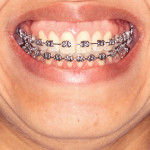 Mostra muita gengiva quando sorri