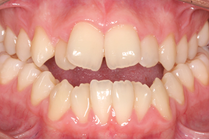 Mastiga de boca aberta