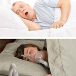 Roncos exagerados, apneia obstrutiva do sono e uso de CPAP