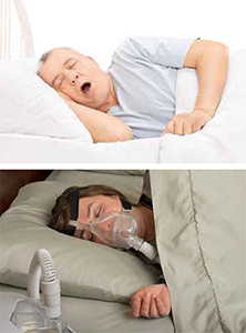 Roncos exagerados, apneia obstrutiva do sono e uso de CPAP