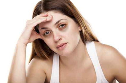 Presença de olheiras