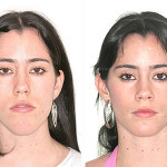 Apresenta uma face alongada